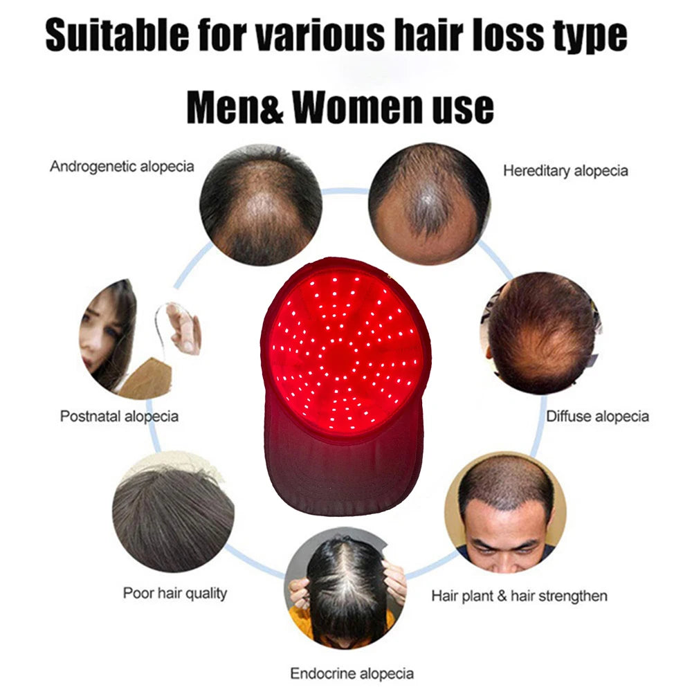 ReGrow Cap: Boost Hair Growth Naturally