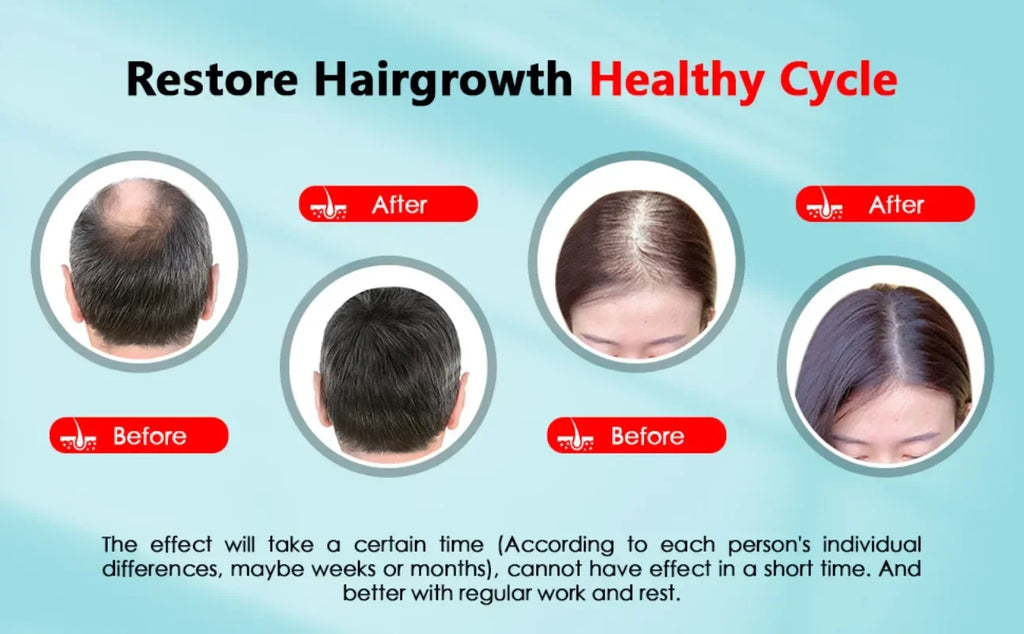 ReGrow Cap: Boost Hair Growth Naturally